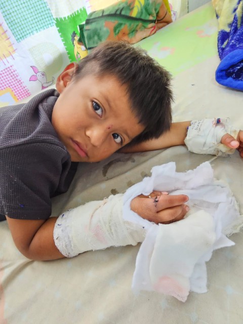 Boy in the hospital who had his finger reattached